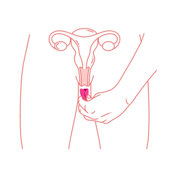 Insert