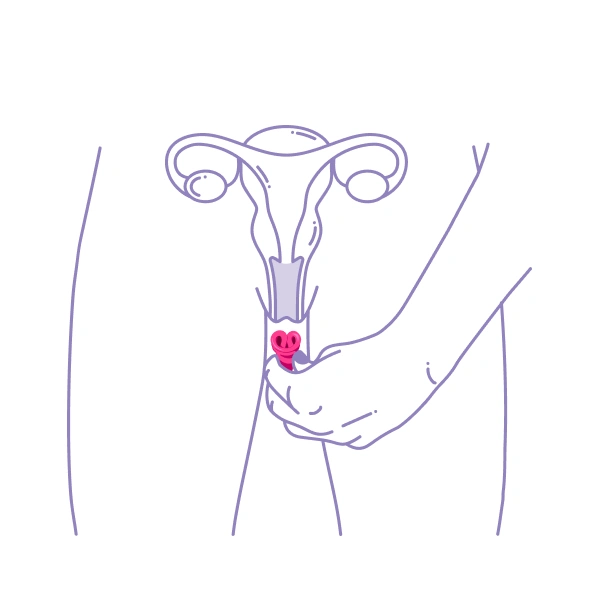 Lily One Insert