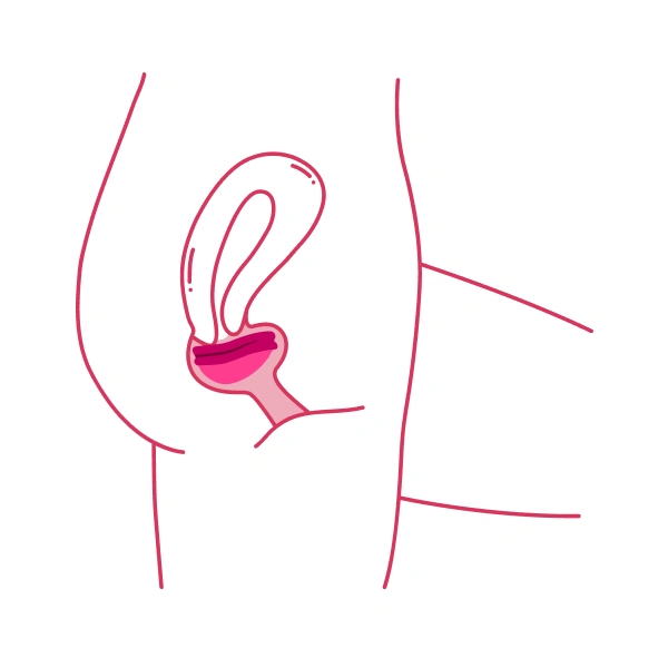 Placement